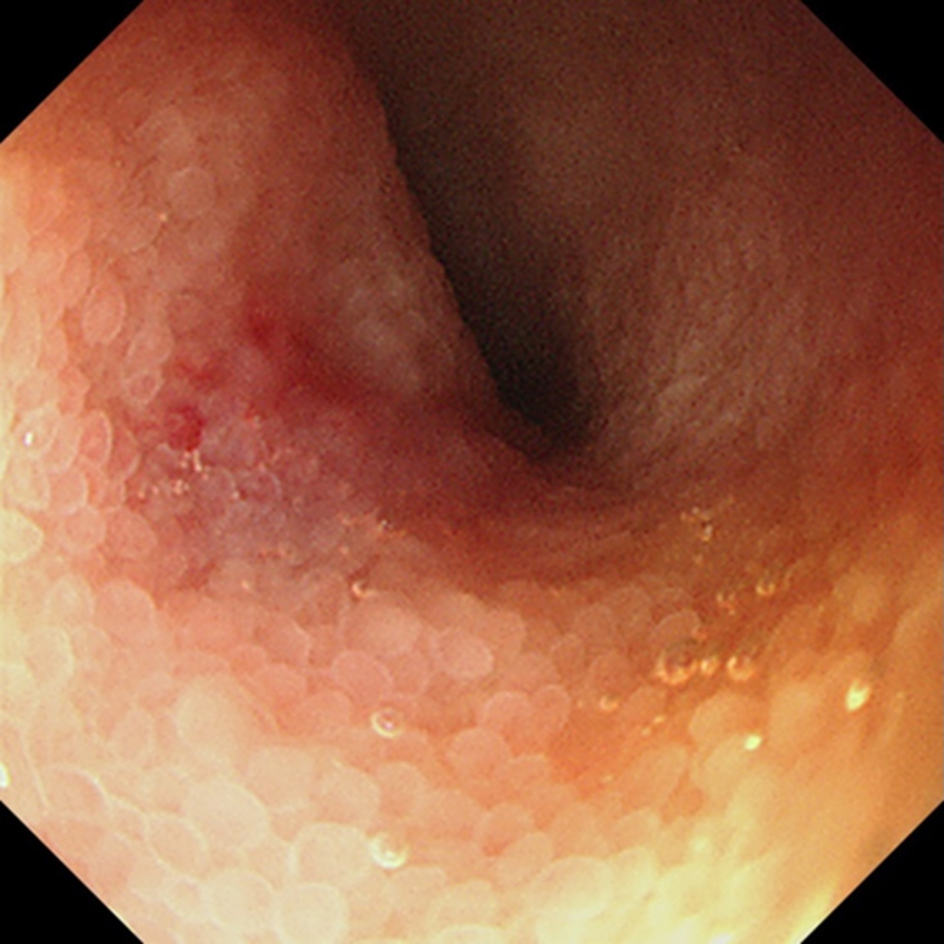 Small intestine, endoscopic image, dog