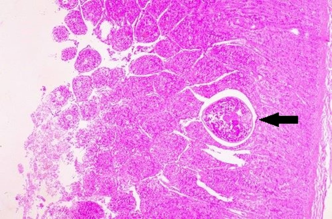 Enfermedad por intoxicación con salmón, microfotografía, intestino delgado, perro