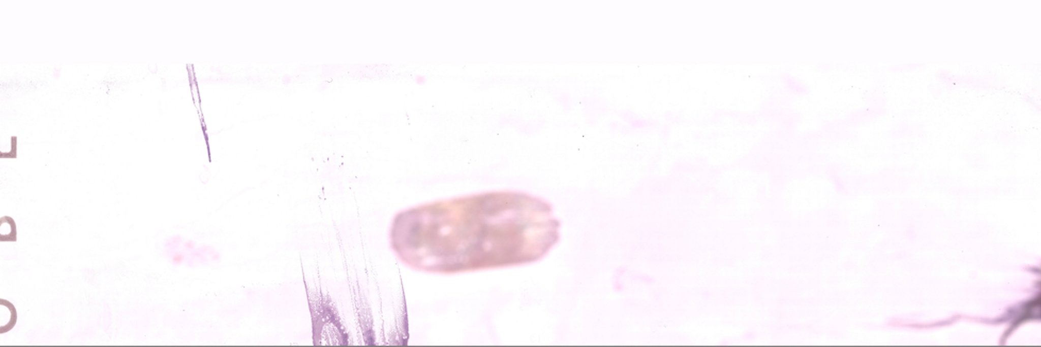 Specimen present on both sides of the slide