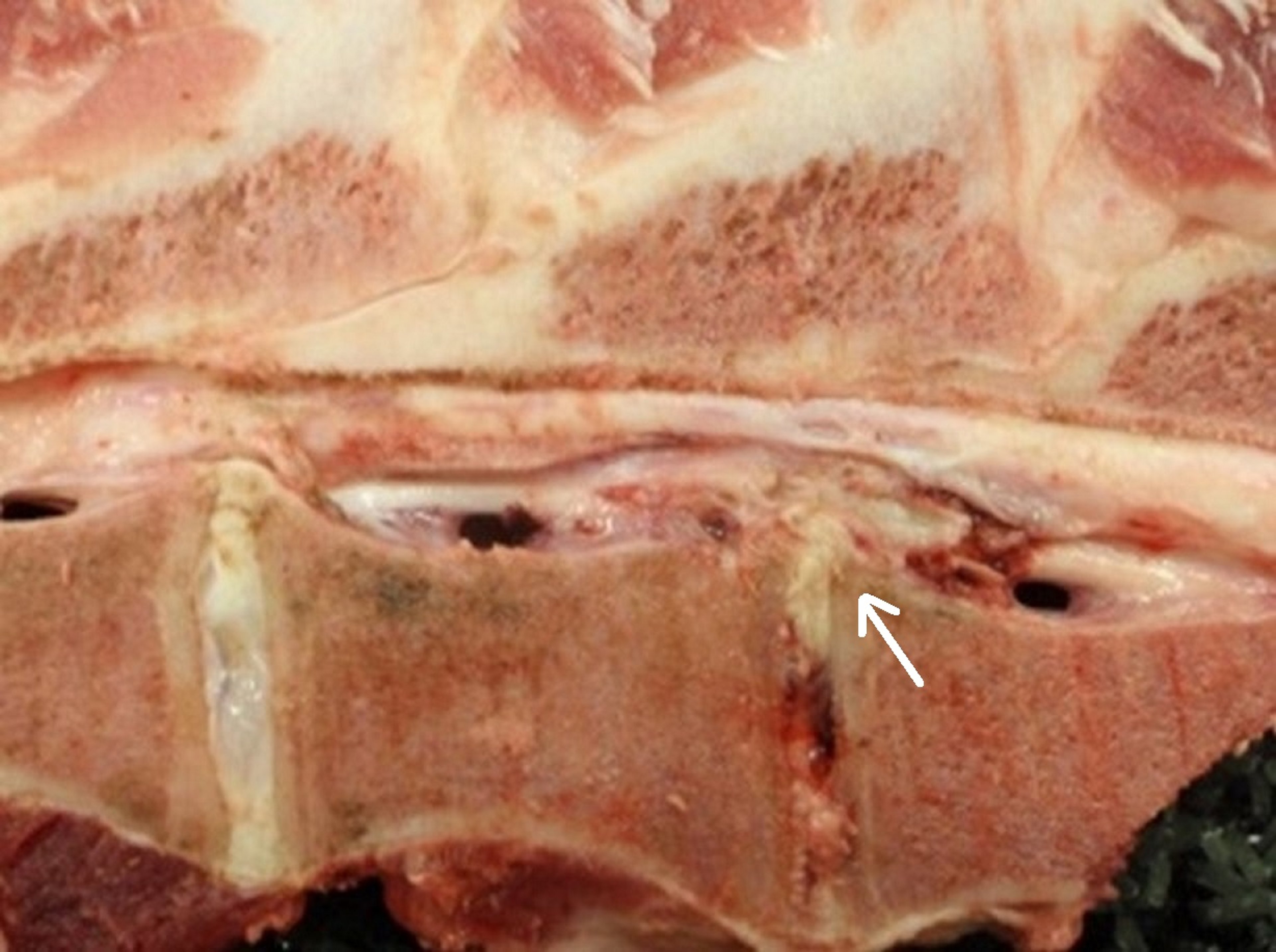 Absceso espinal, cerda