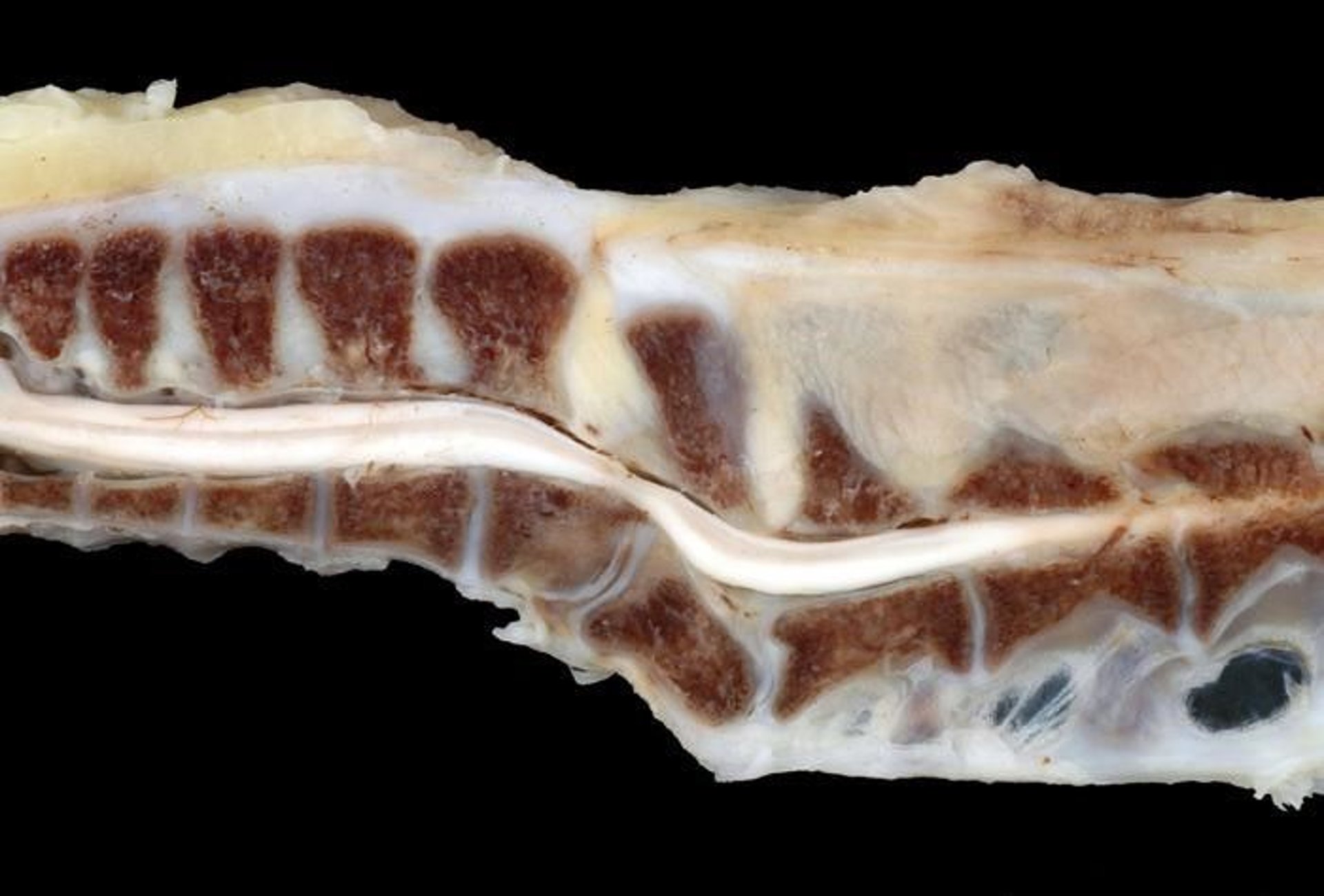 Spondylolisthesis, broiler