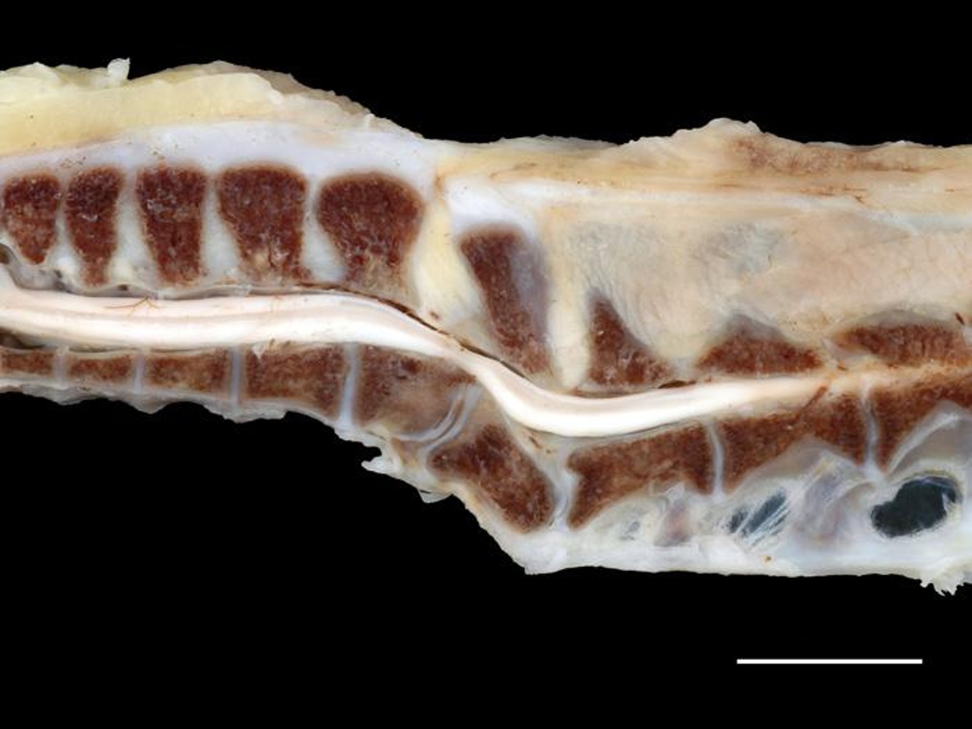 Espondilolistesis, pollo de engorde de 37 días de edad