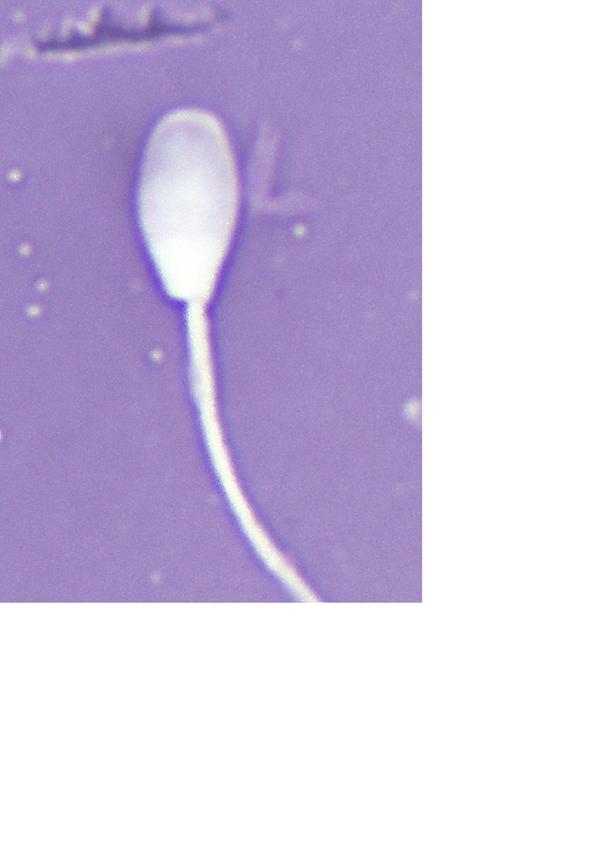 Espermatozoides, semental