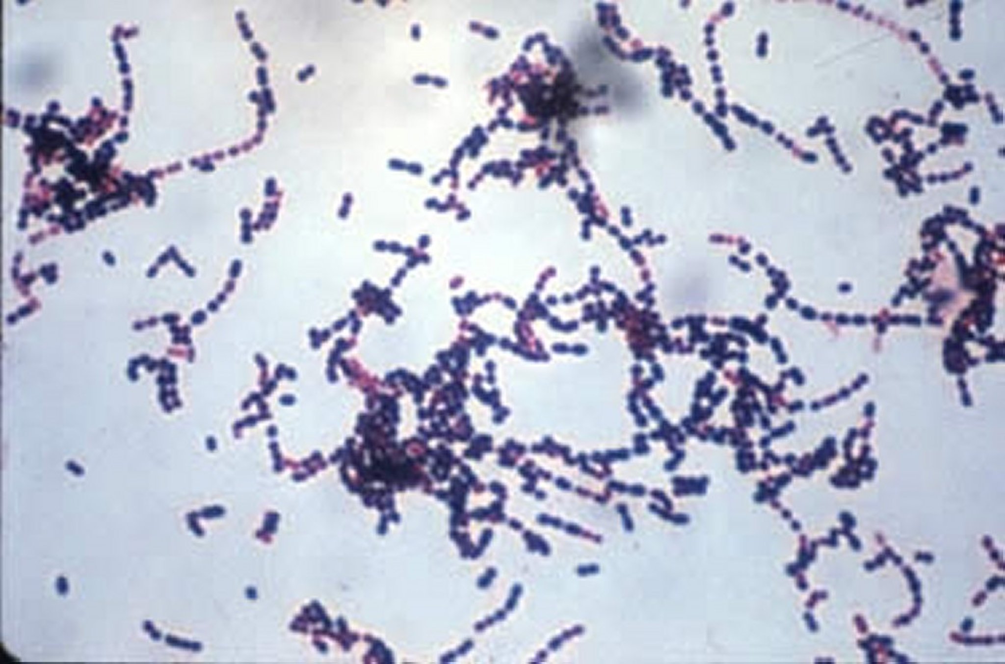 <i >Streptococcus suis</i>, tinción de Gram