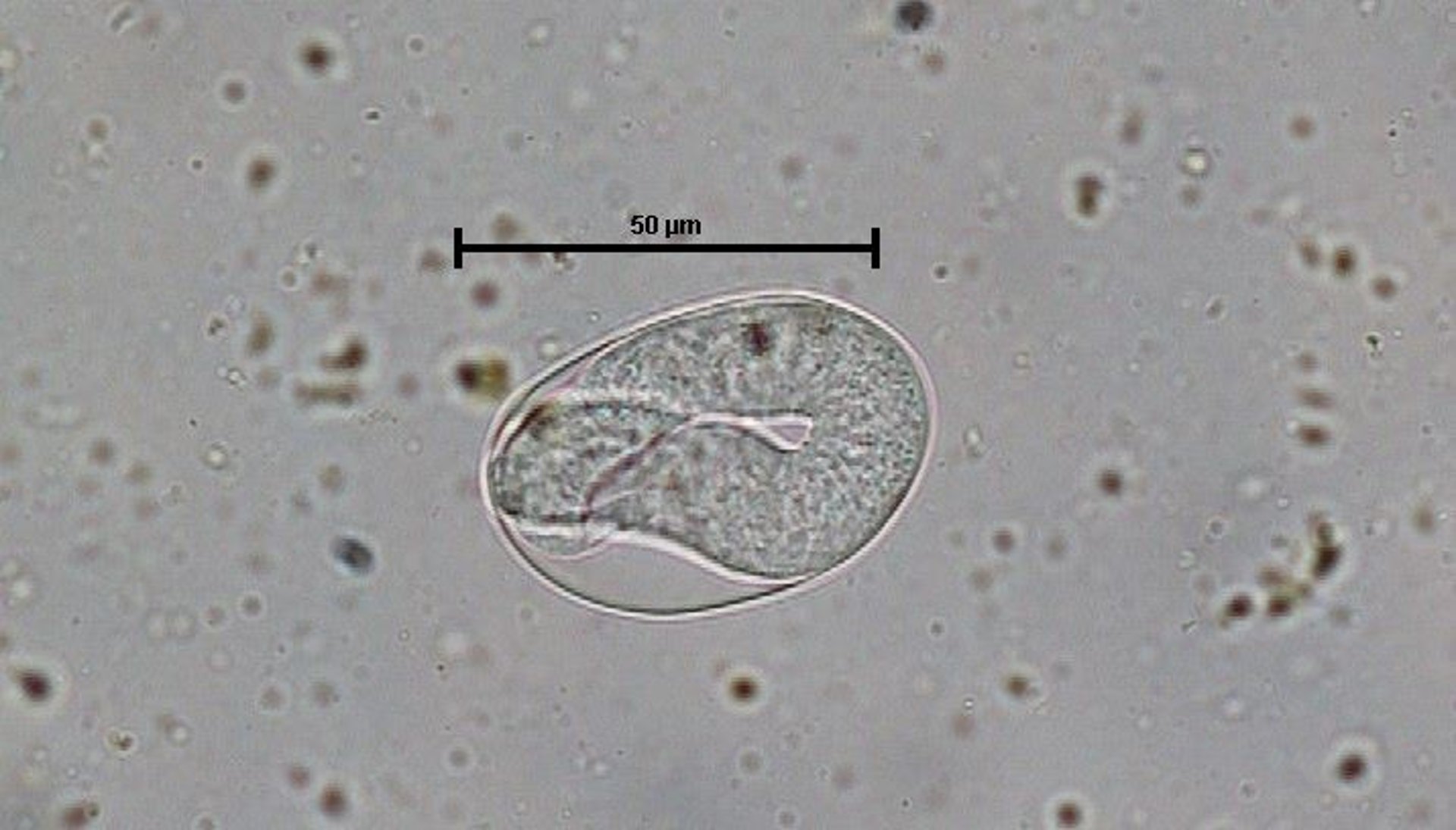 <i >Strongyloides westeri</i>, egg