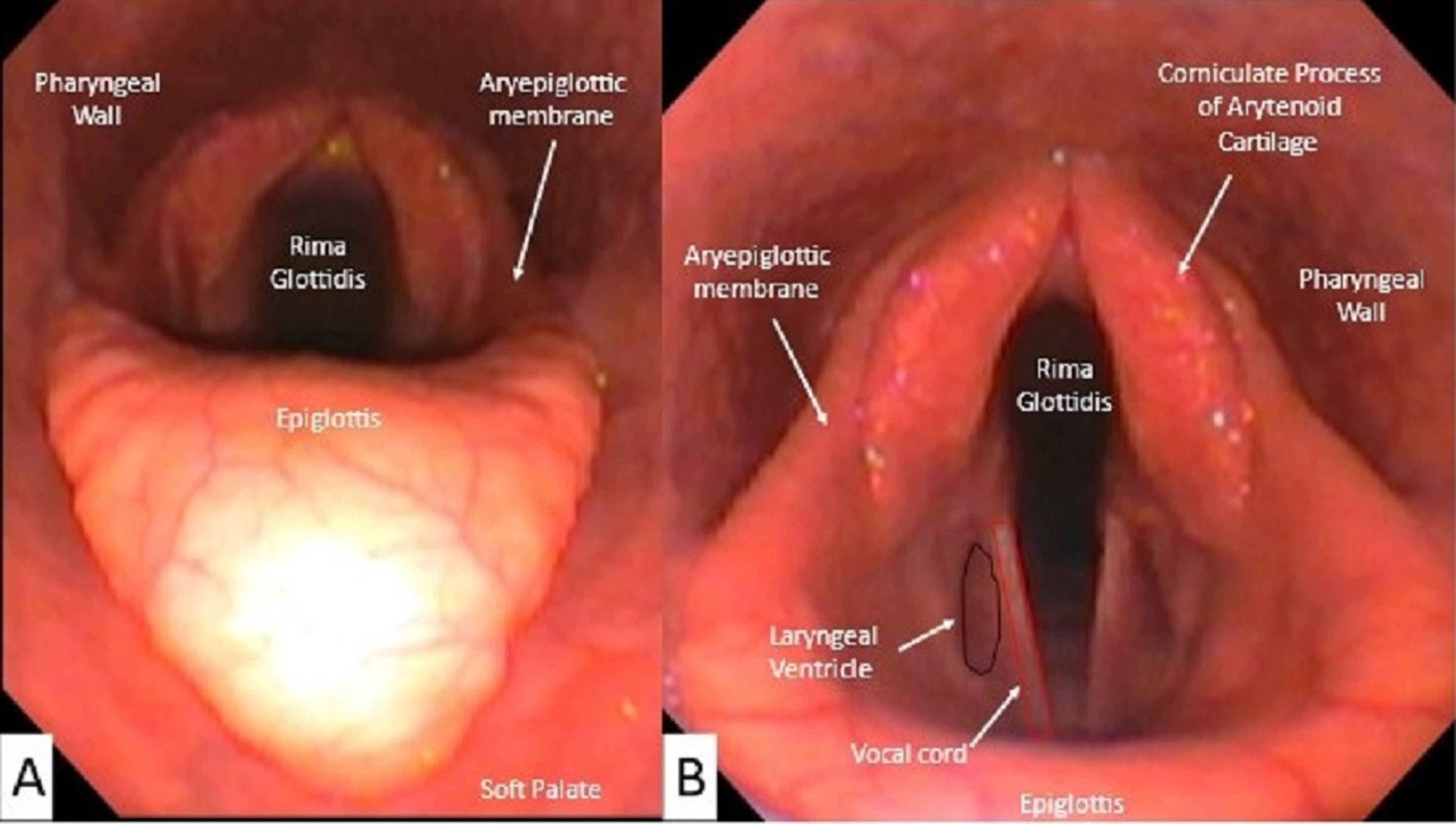 Structures of the larynx, horse