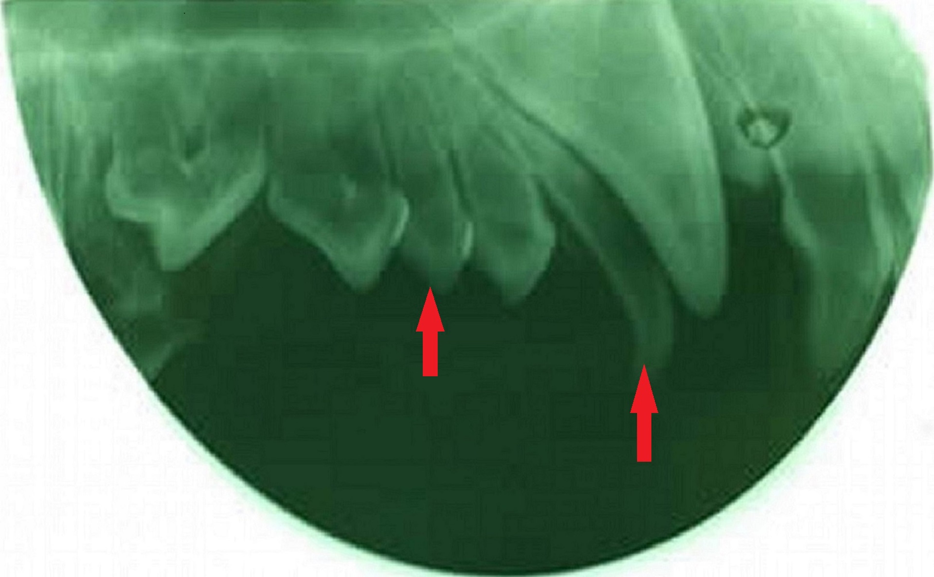 Dientes supernumerarios, perro, radiografía
