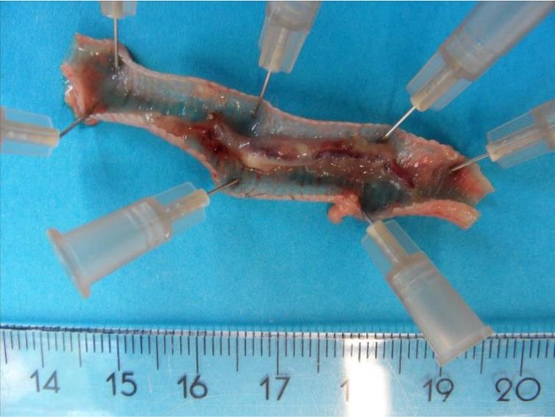 <i >Syngamus trachea</i>, tráquea, pollo