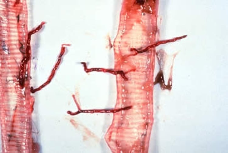 <i >Syngamus trachea</i> worms, tracheal lumen, poultry
