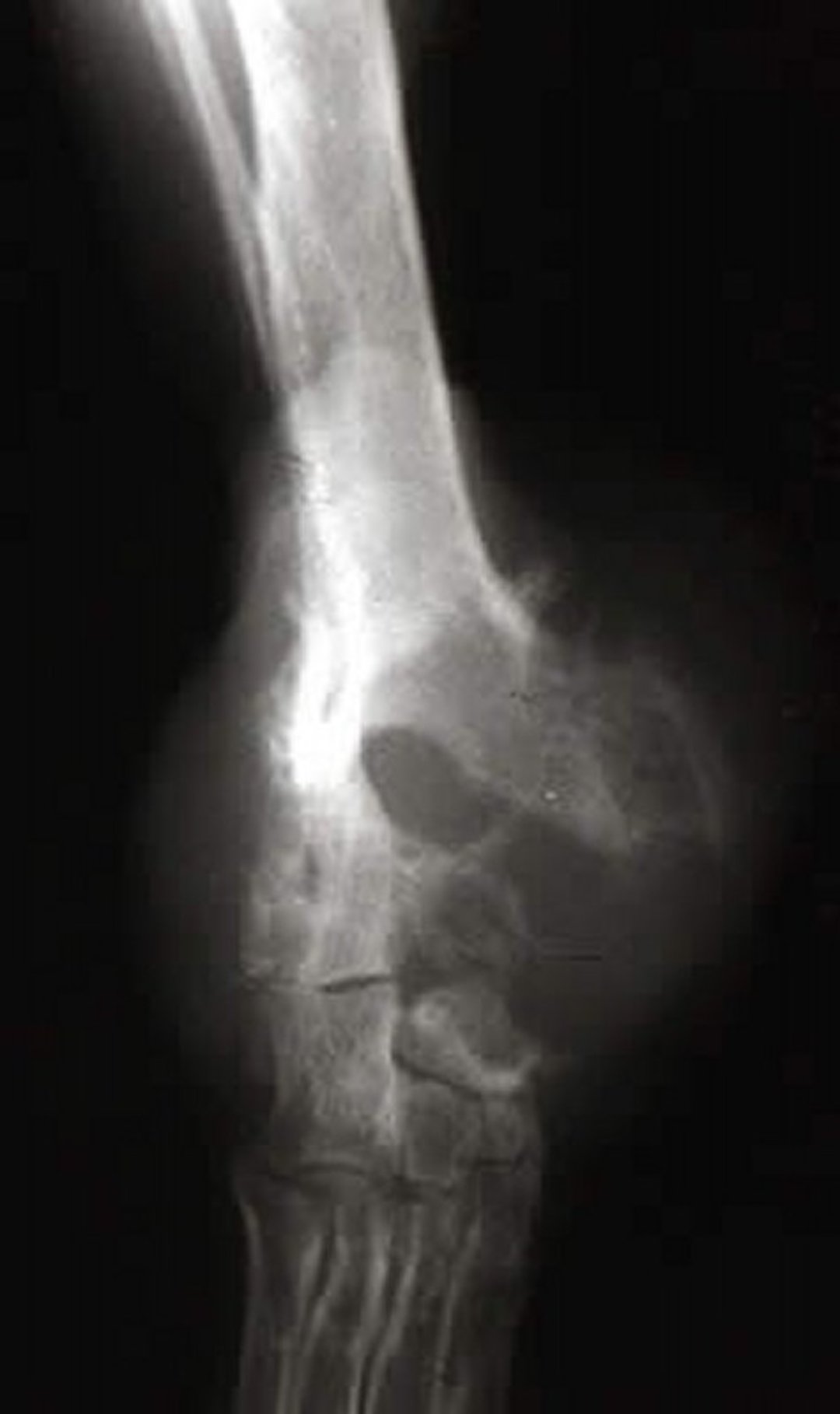 Synovial cell sarcoma, radiograph, dog