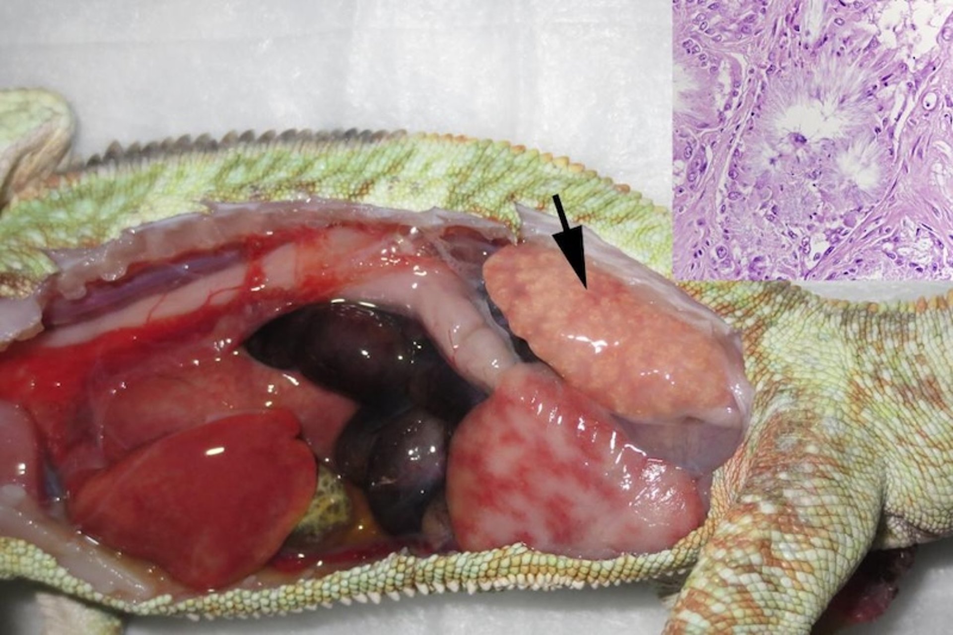 Systemic gout, chameleon