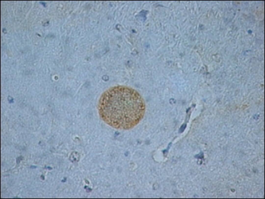 <i >Toxoplasma gondii</i> tissue cyst, immunohistochemical staining, photomicrograph