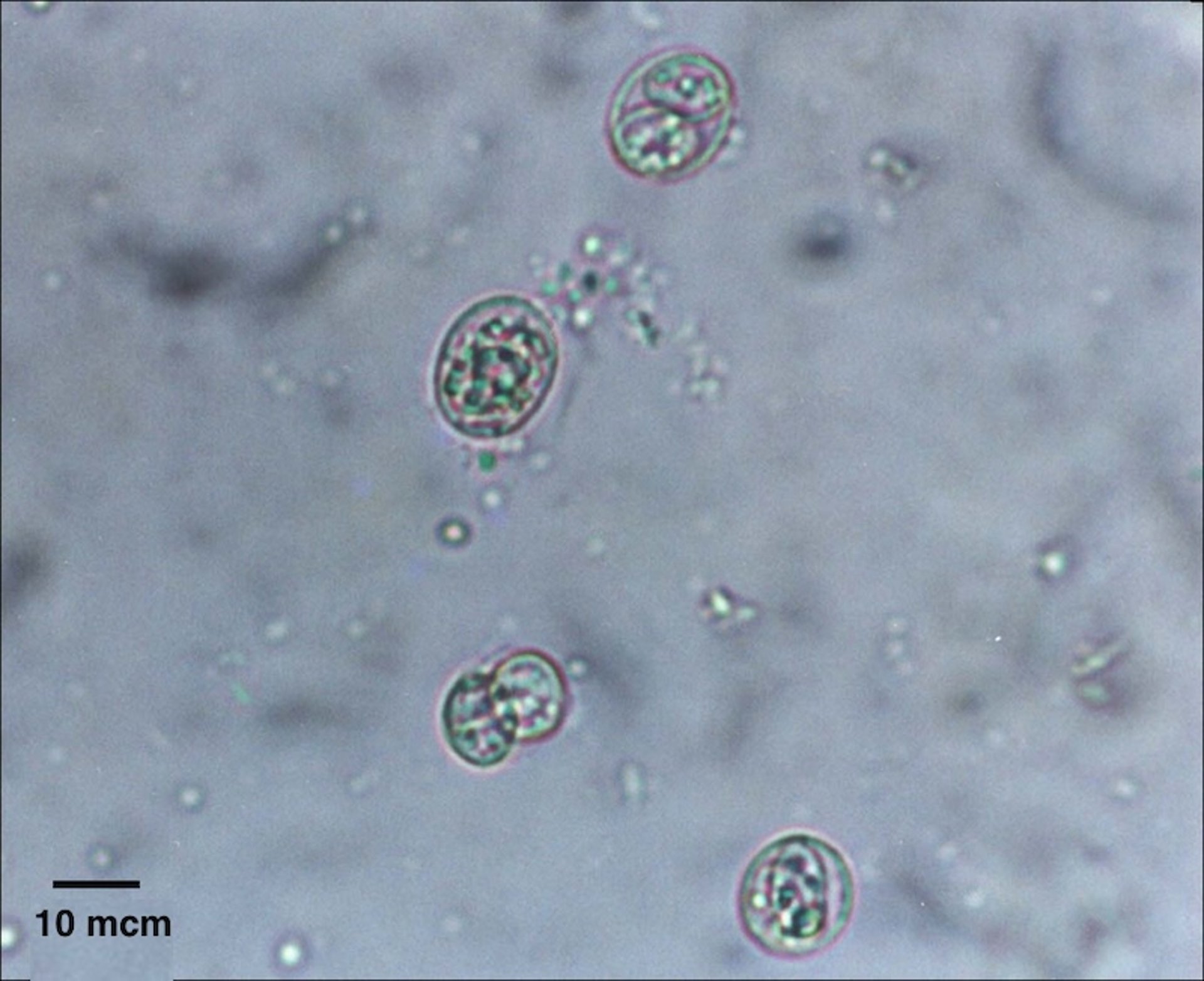 <i >Toxoplasma gondii</i> oocysts, feces, cat, photomicrograph