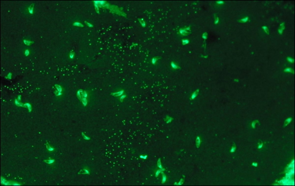 <i >Toxoplasma gondii</i>, positive immunofluorescence assay reaction