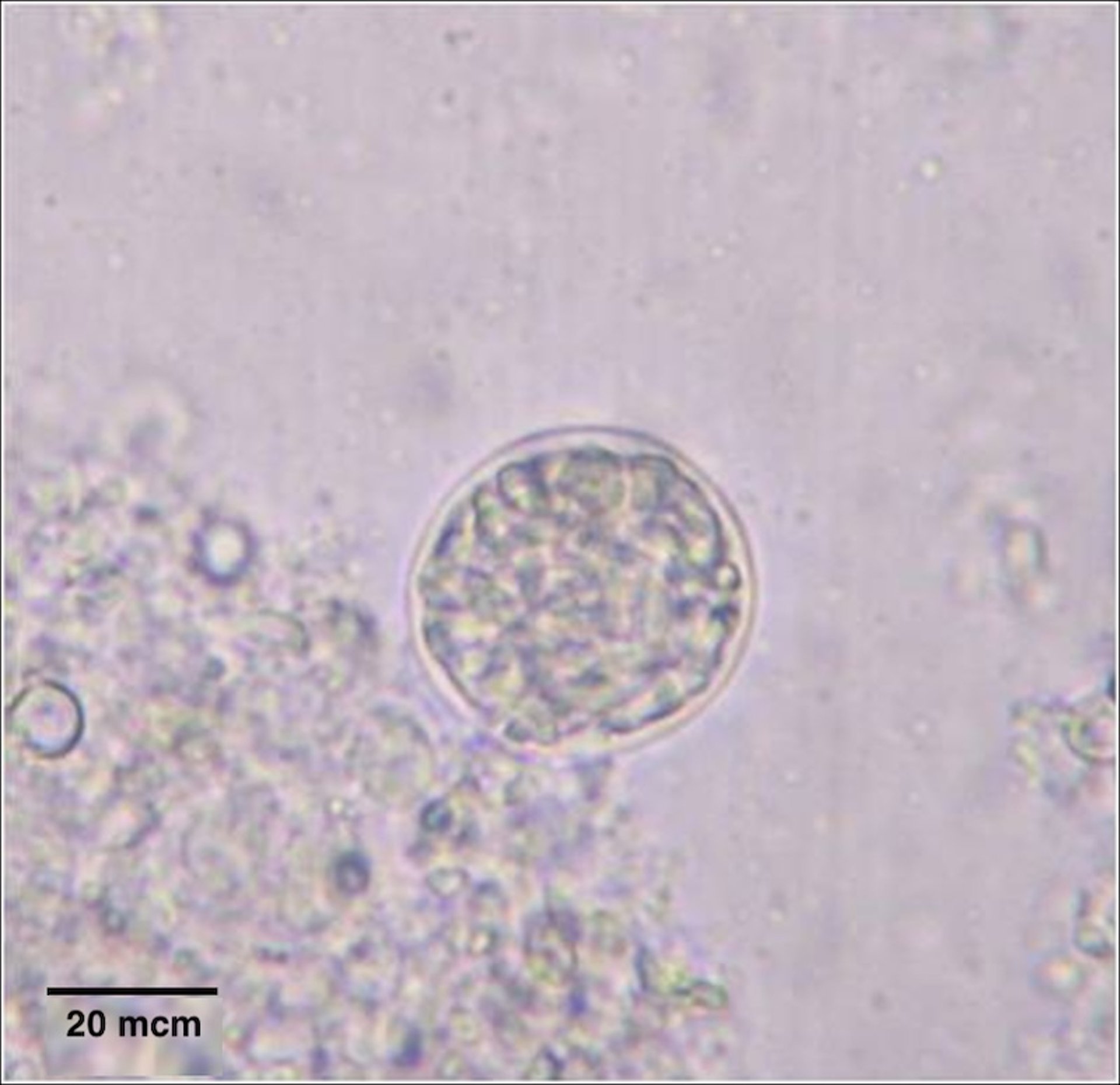 <i >Toxoplasma gondii</i> tissue cyst, mouse, photomicrograph