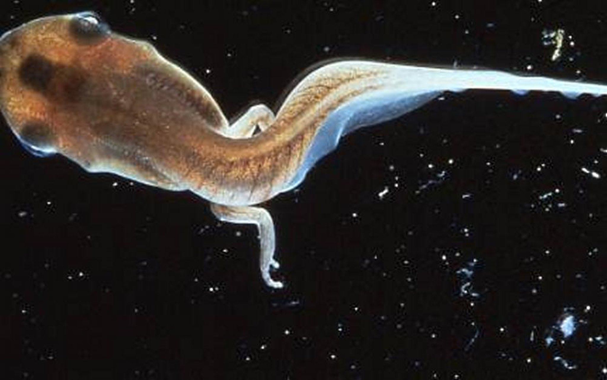 Scoliosis due to vitamin B deficiency, tadpole