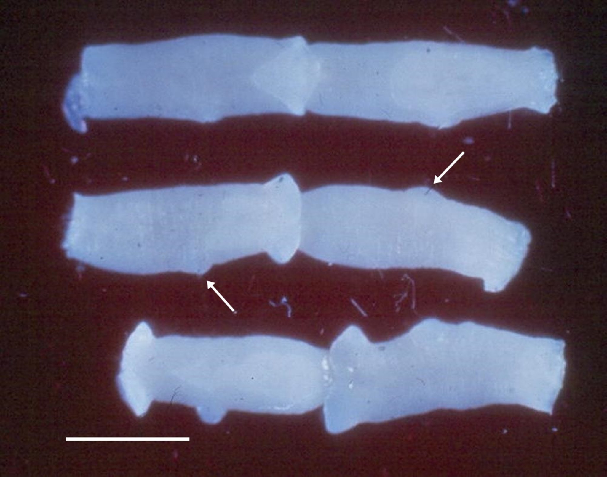 Segments of a <i >Taenia</i> sp, dog