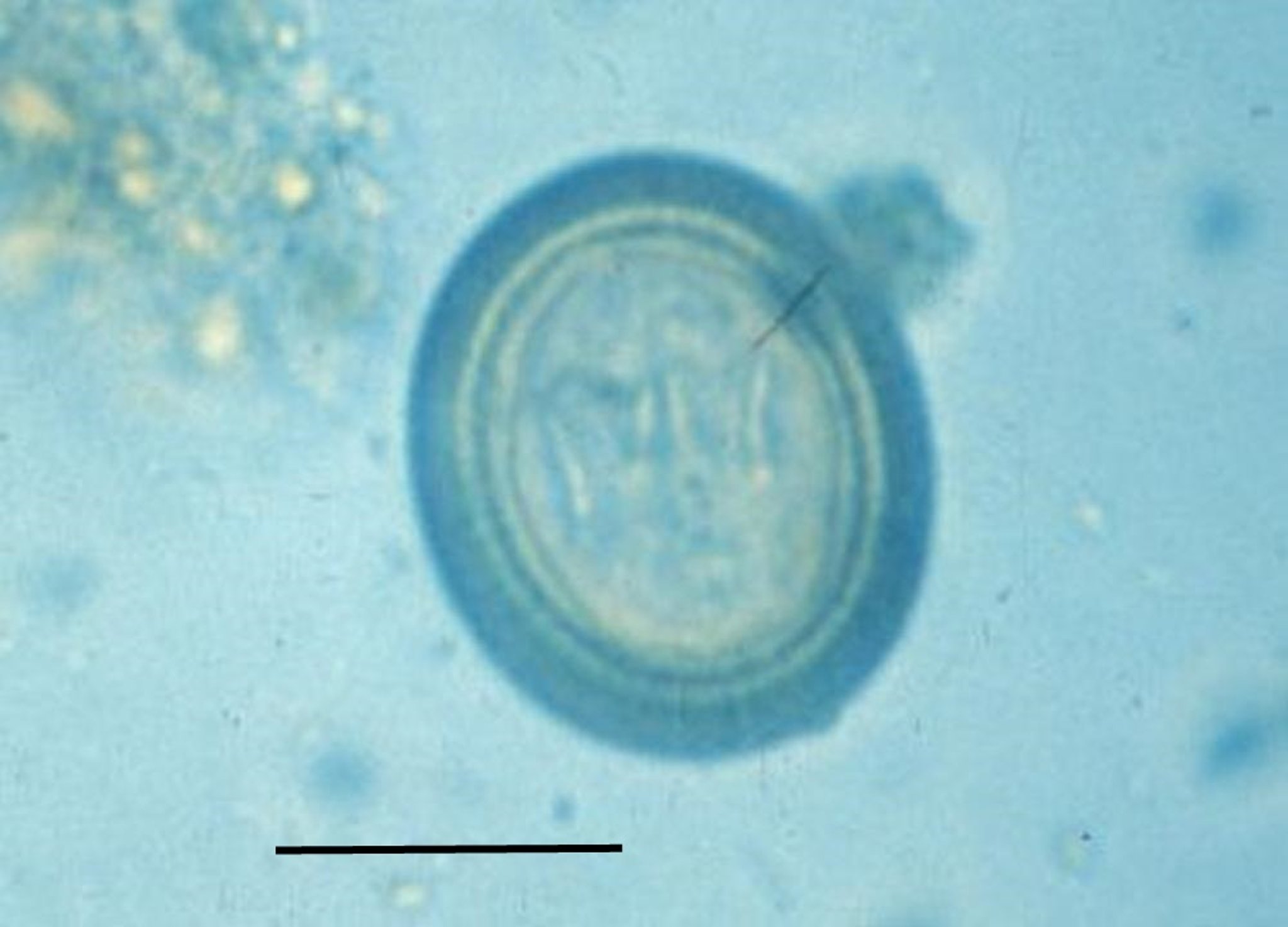 Egg, <i >Taenia</i>-type, dog