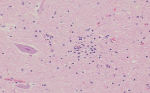 Teschovirus encephalomyelitis, neuronal necrosis