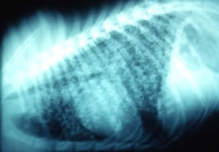 Thoracic blastomycosis, radiograph, dog
