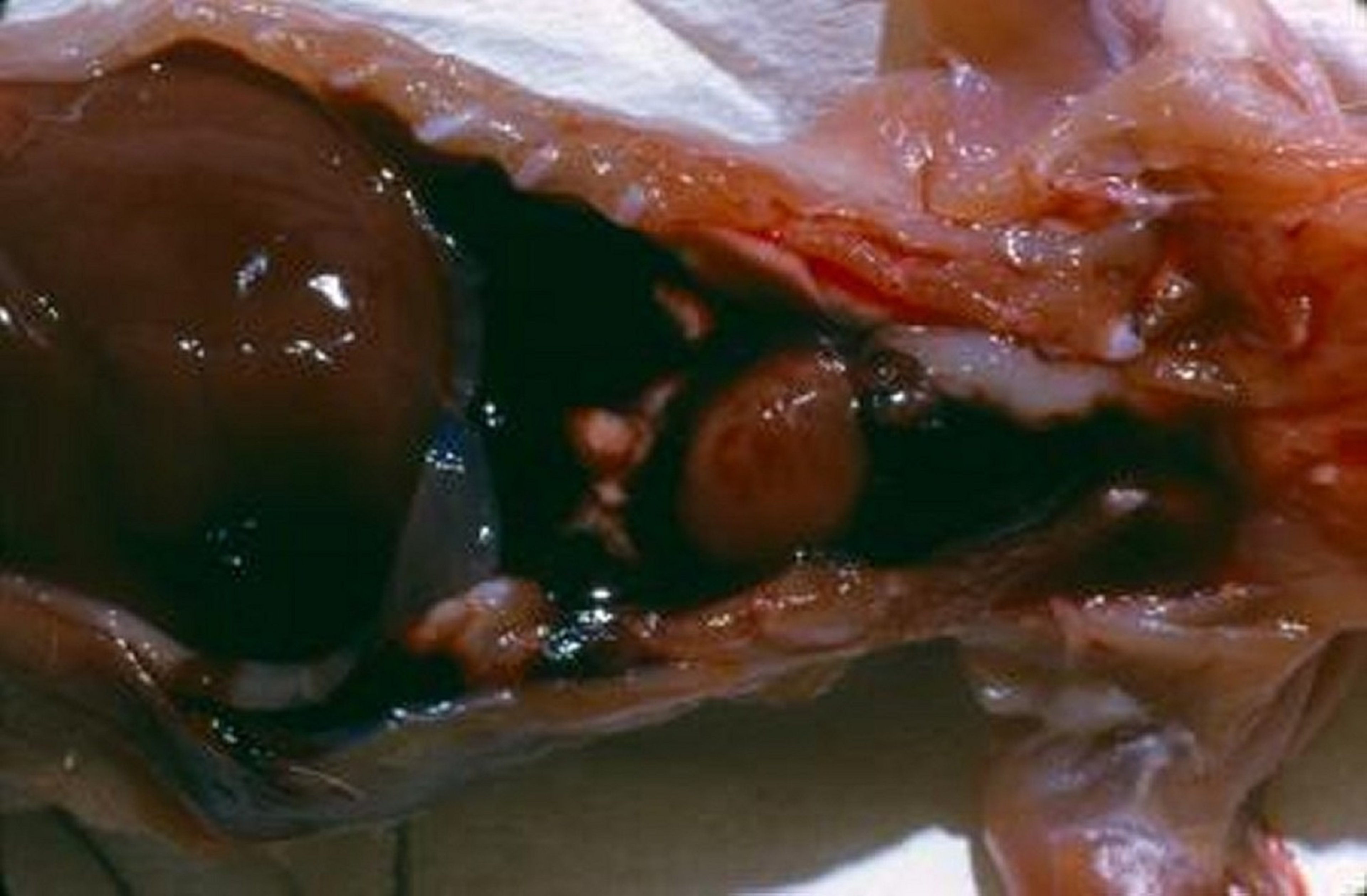 Thoracic hemorrhage, anticoagulant rodenticide poisoning