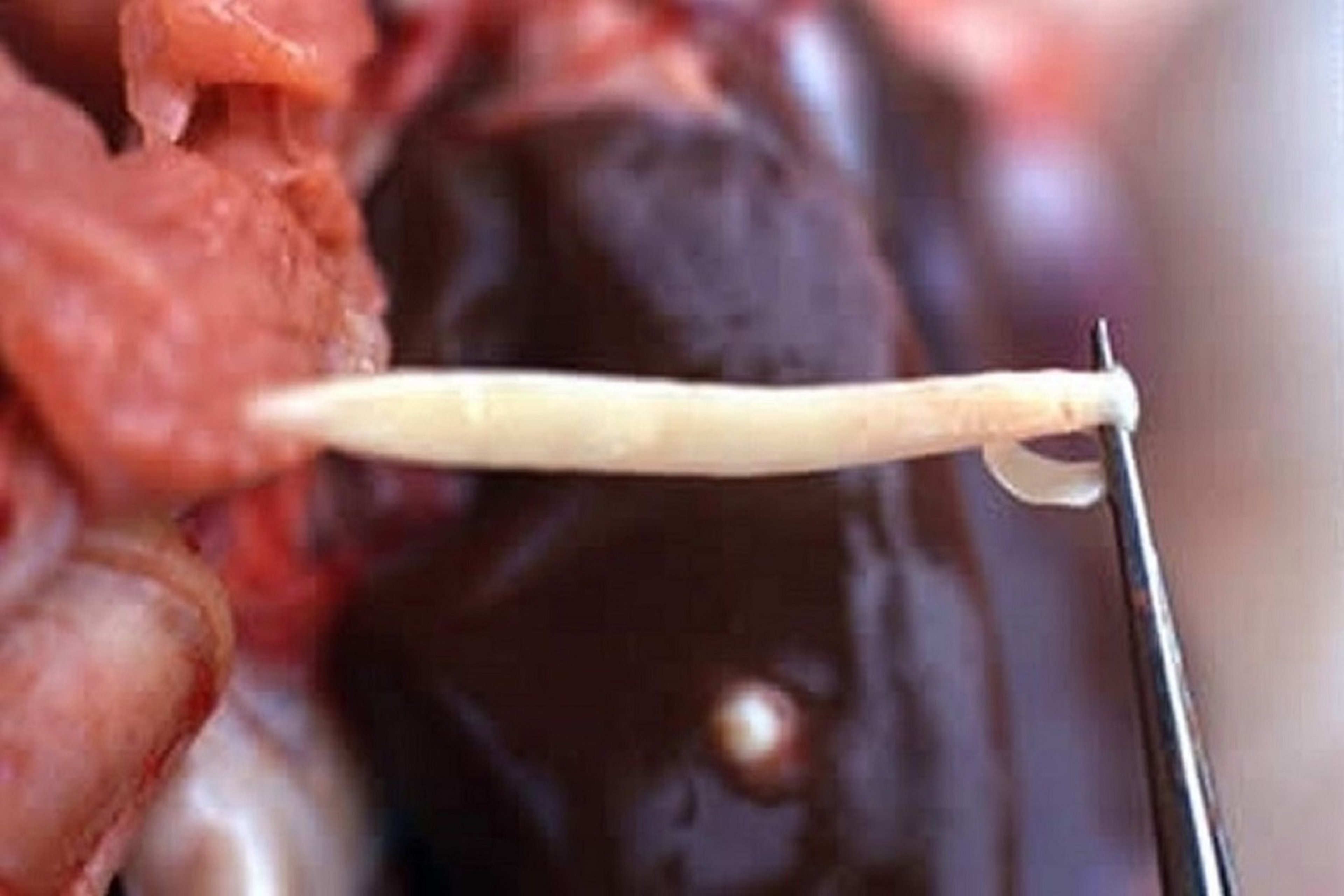 <i >Thysanosoma actinioides</i>, adult, sheep