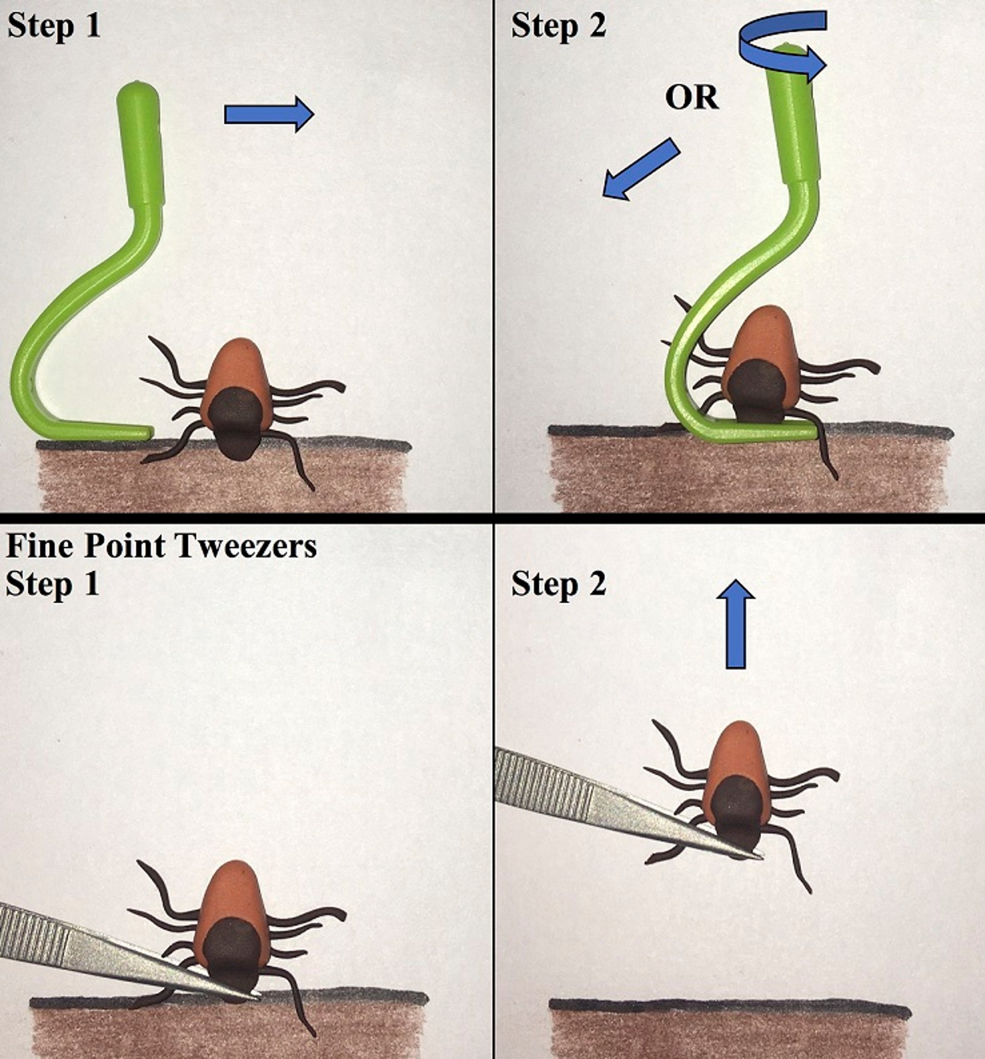 Tick Removal