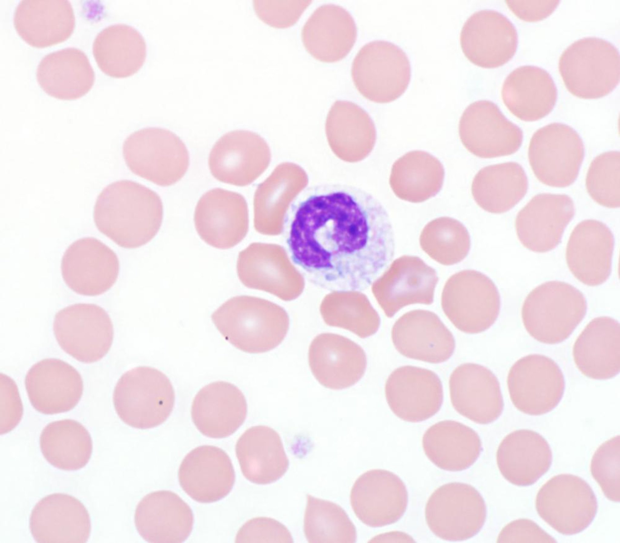 Toxic neutrophil, blood smear, dog