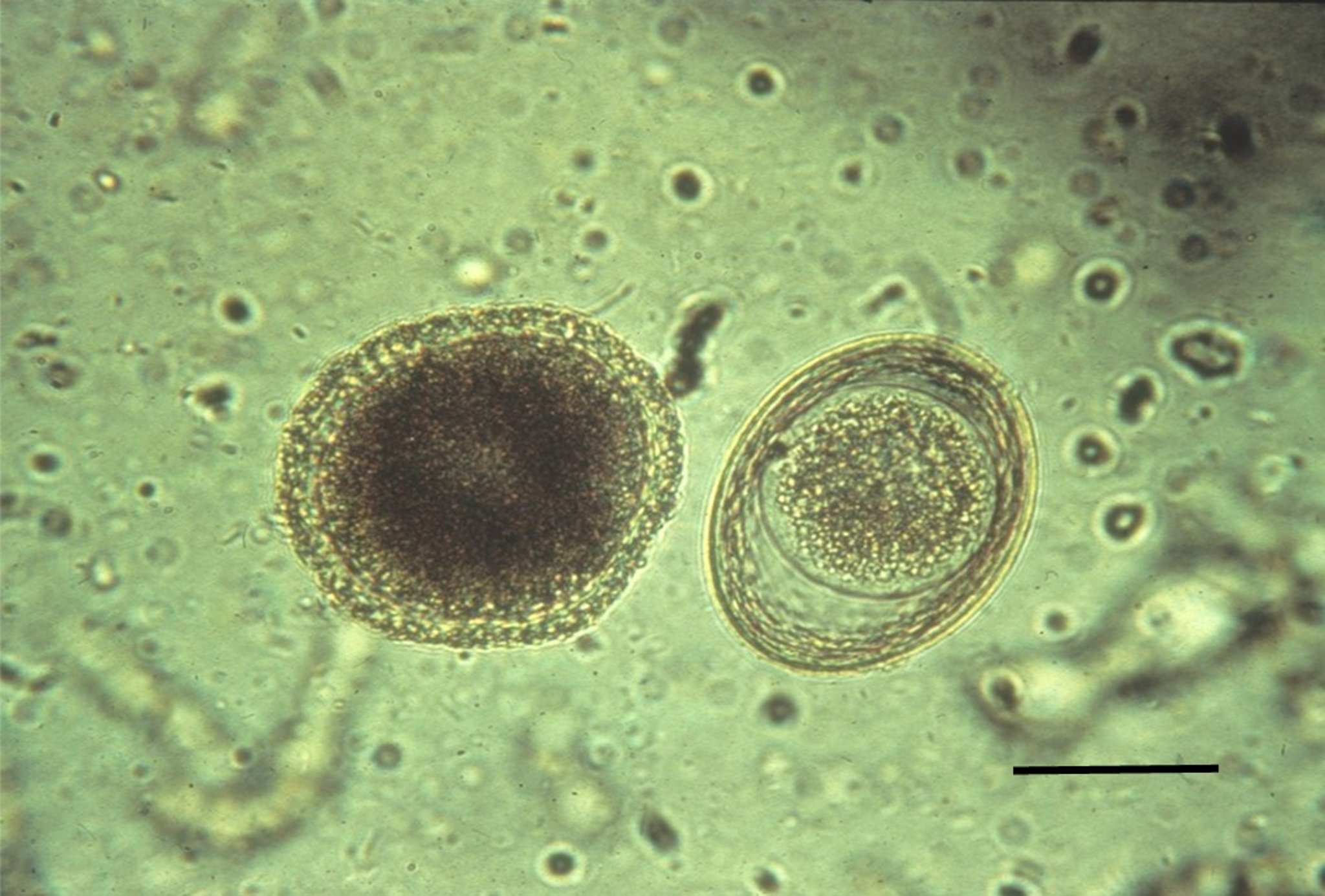 Roundworm eggs, dog