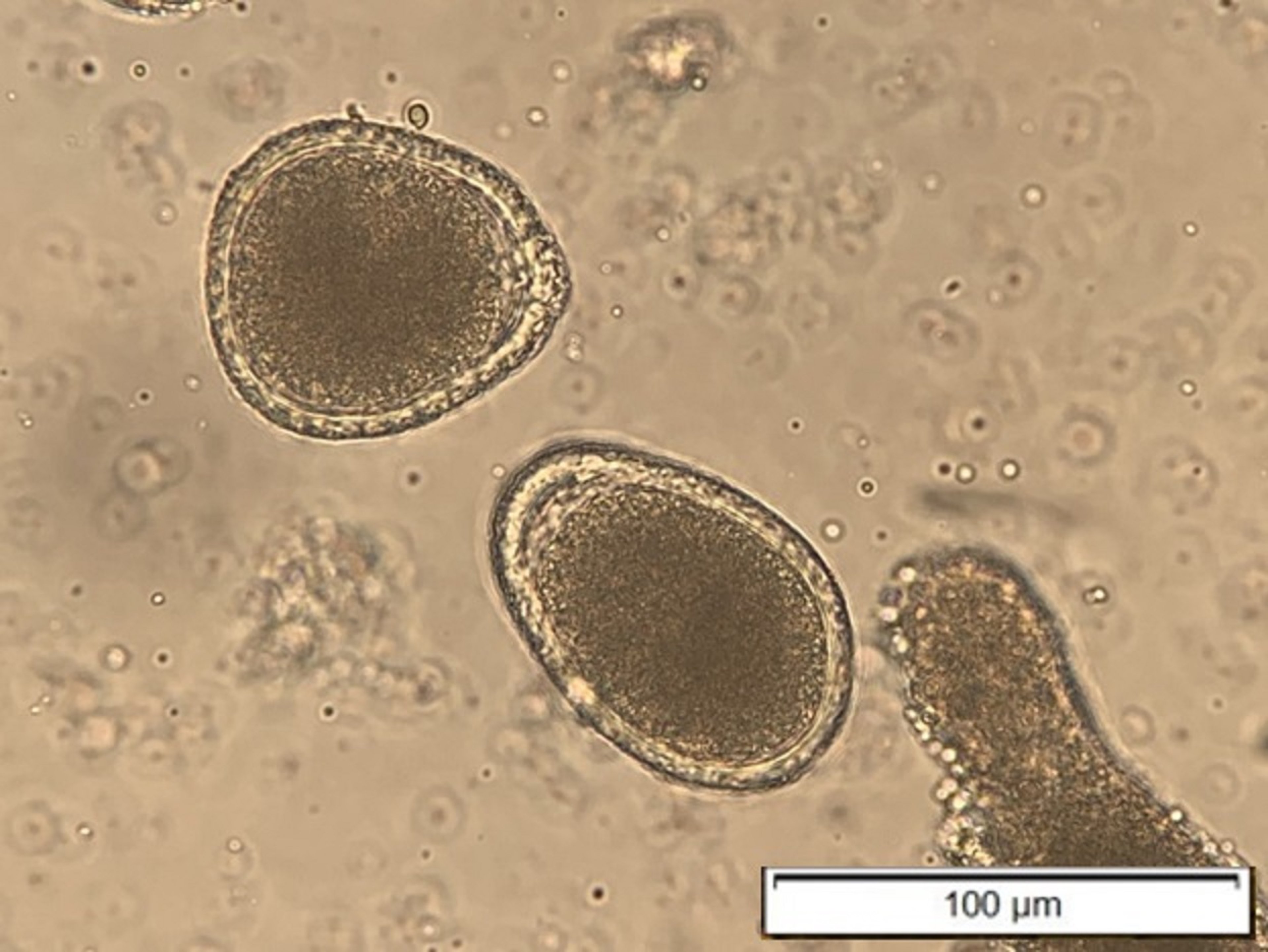 <i >Toxocara vitulorum</i> eggs