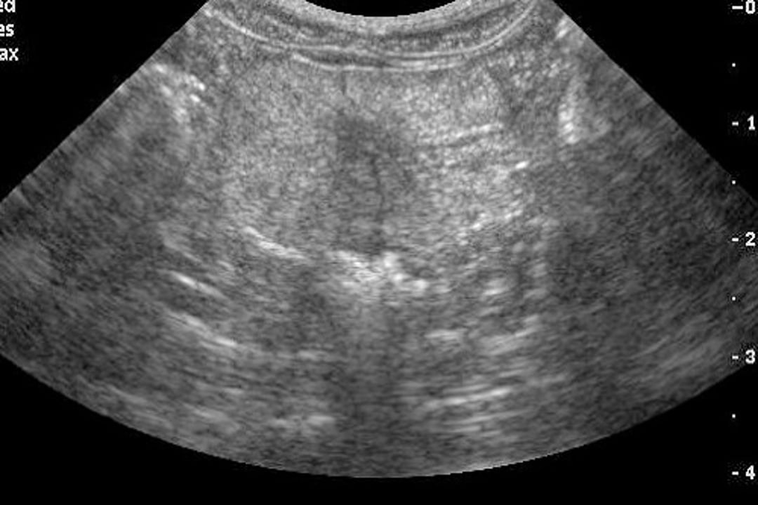 Transverse ultrasonography, canine prostate