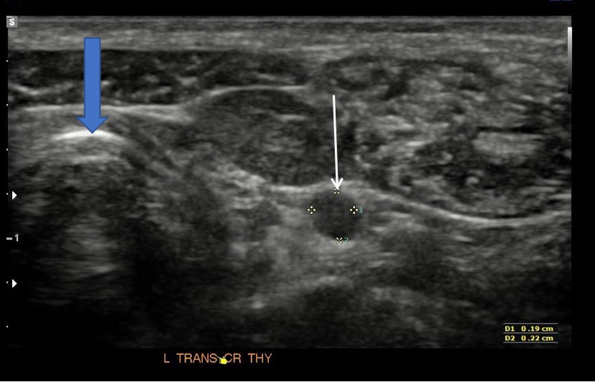 Thyroid, transverse ultrasonography, dog