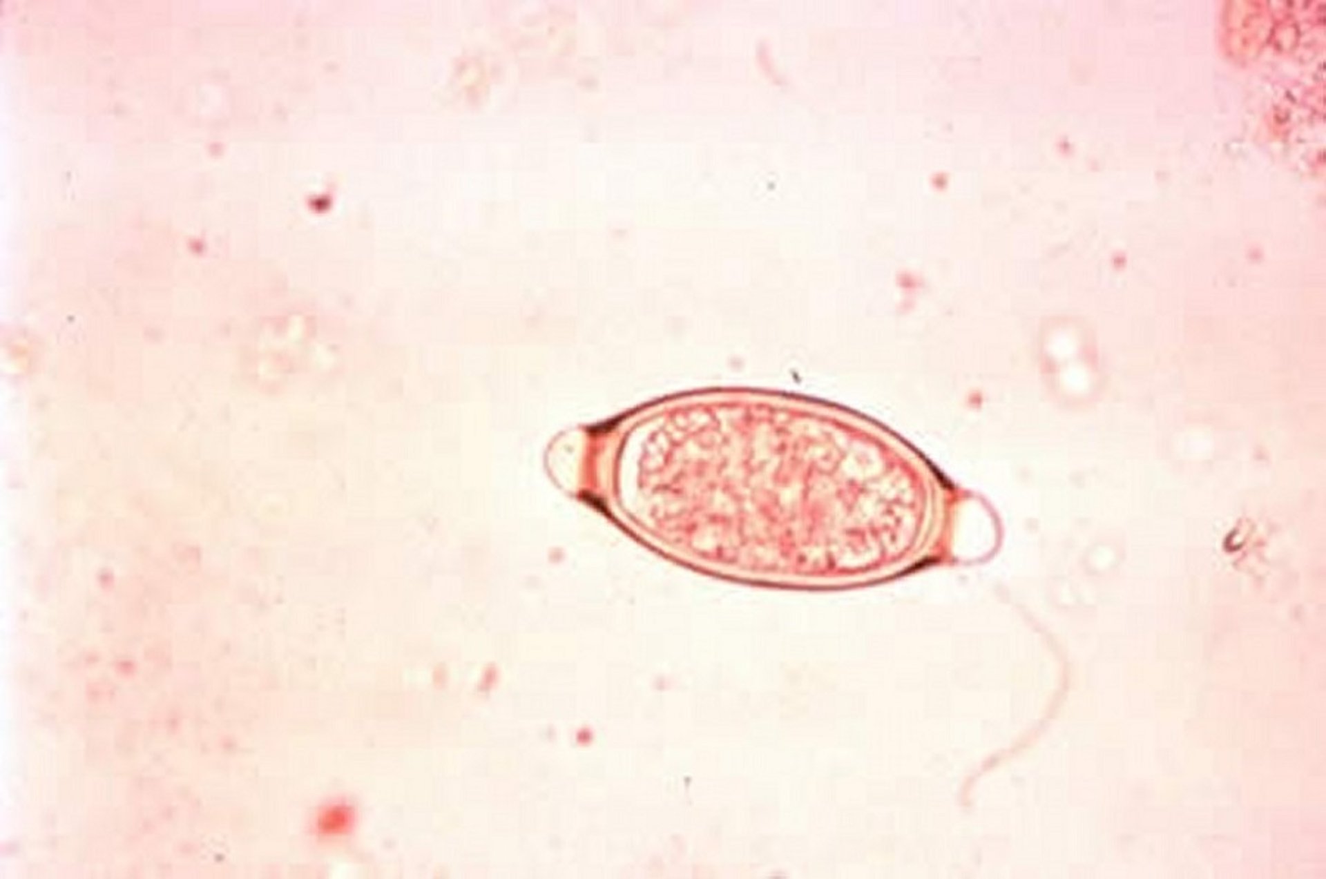 <i >Trichuris suis</i> egg