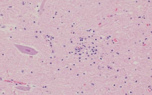 Encefalomielitis por teschovirus, necrosis neuronal