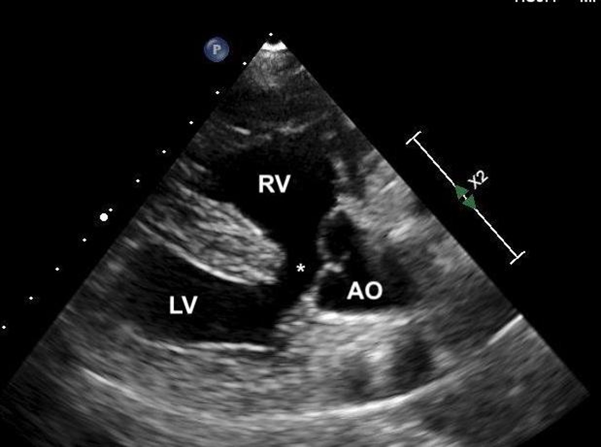 Tetralogia de Fallot, ecocardiograma, cão