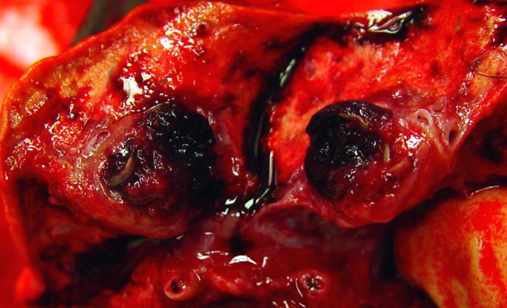 Trombo, arteria pulmonar, perro
