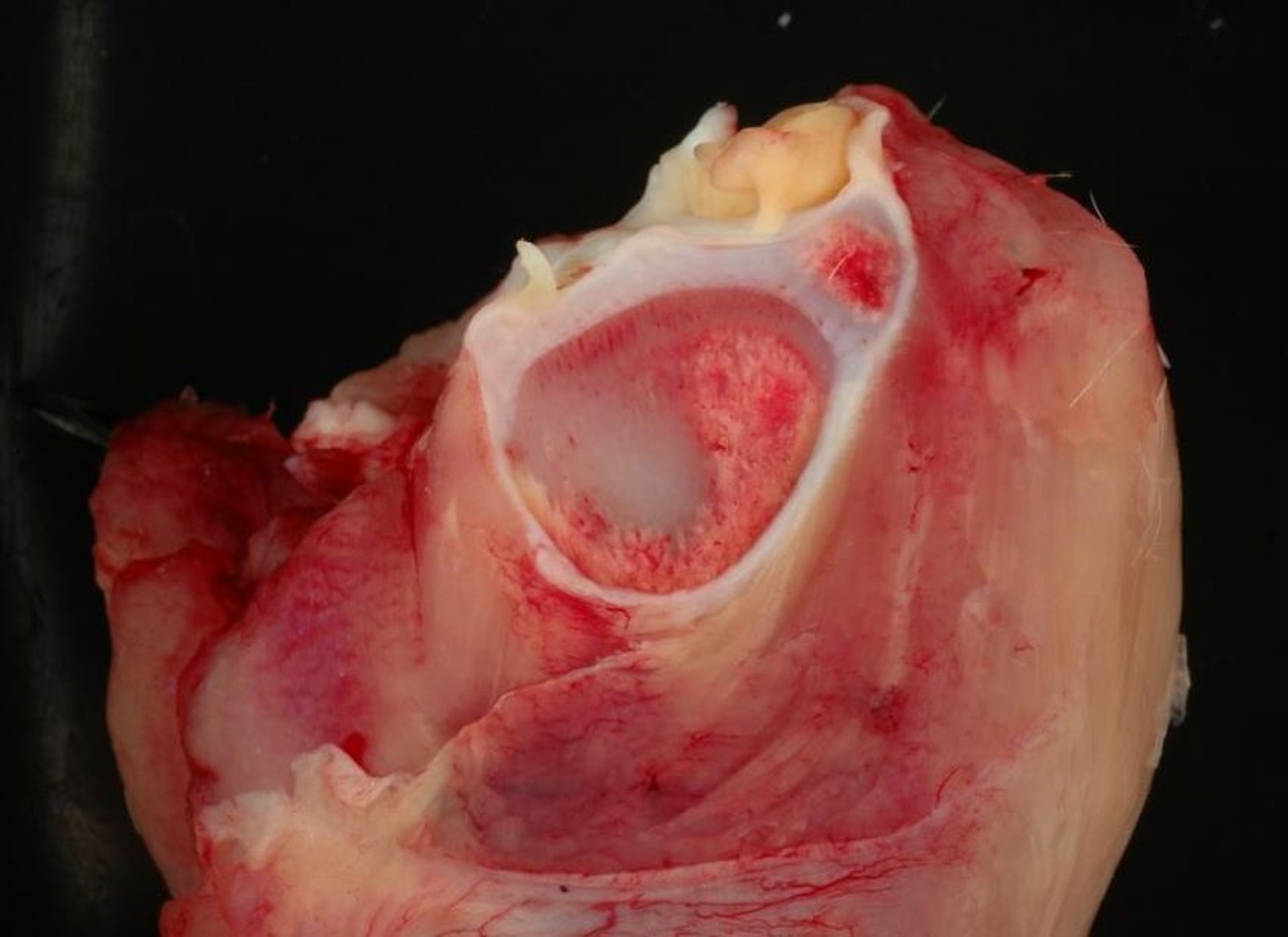 Tibial dyschondroplasia, broiler