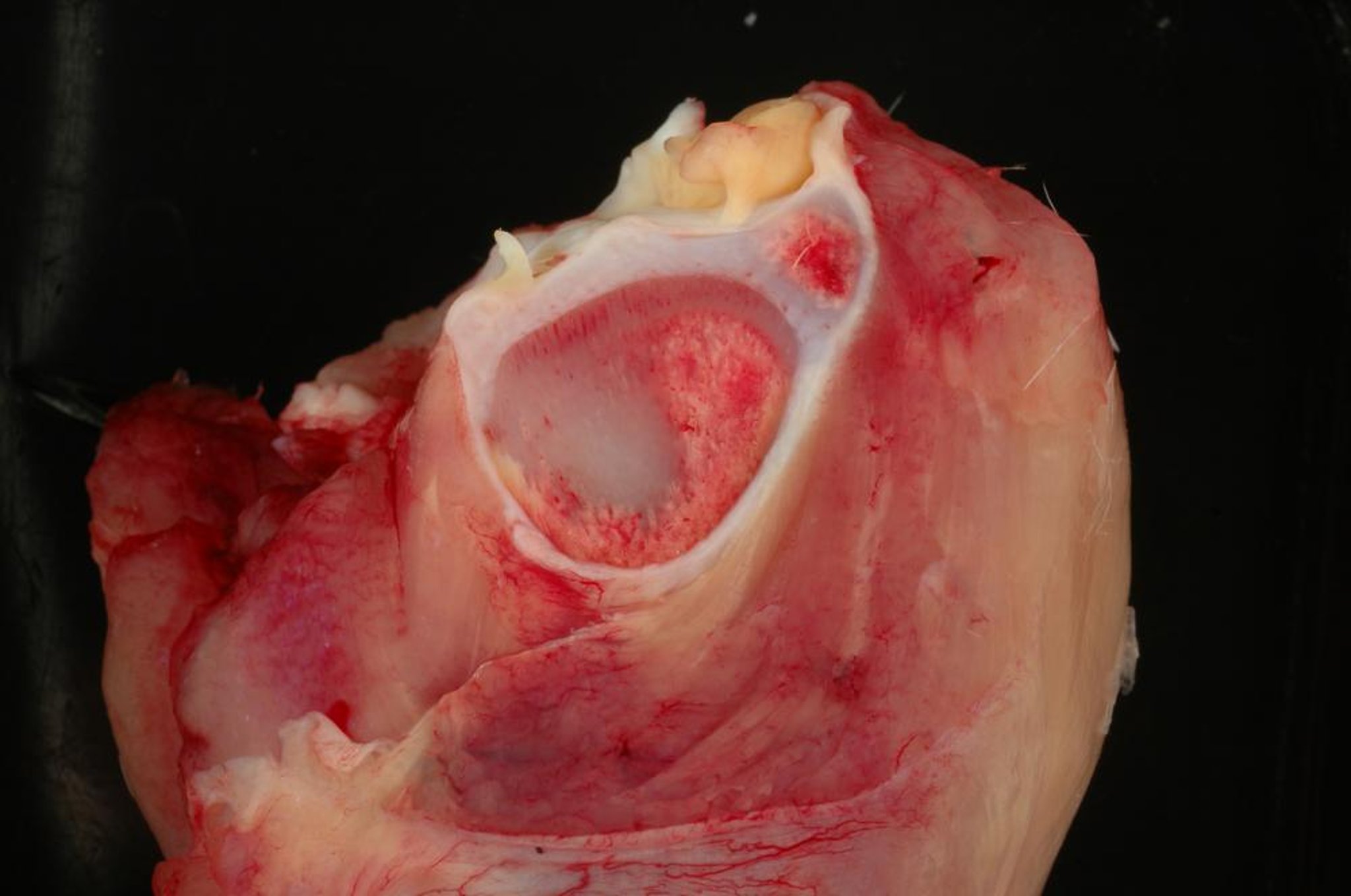 Condrodisplasia tibial, pollo de engorde de 36 días de edad