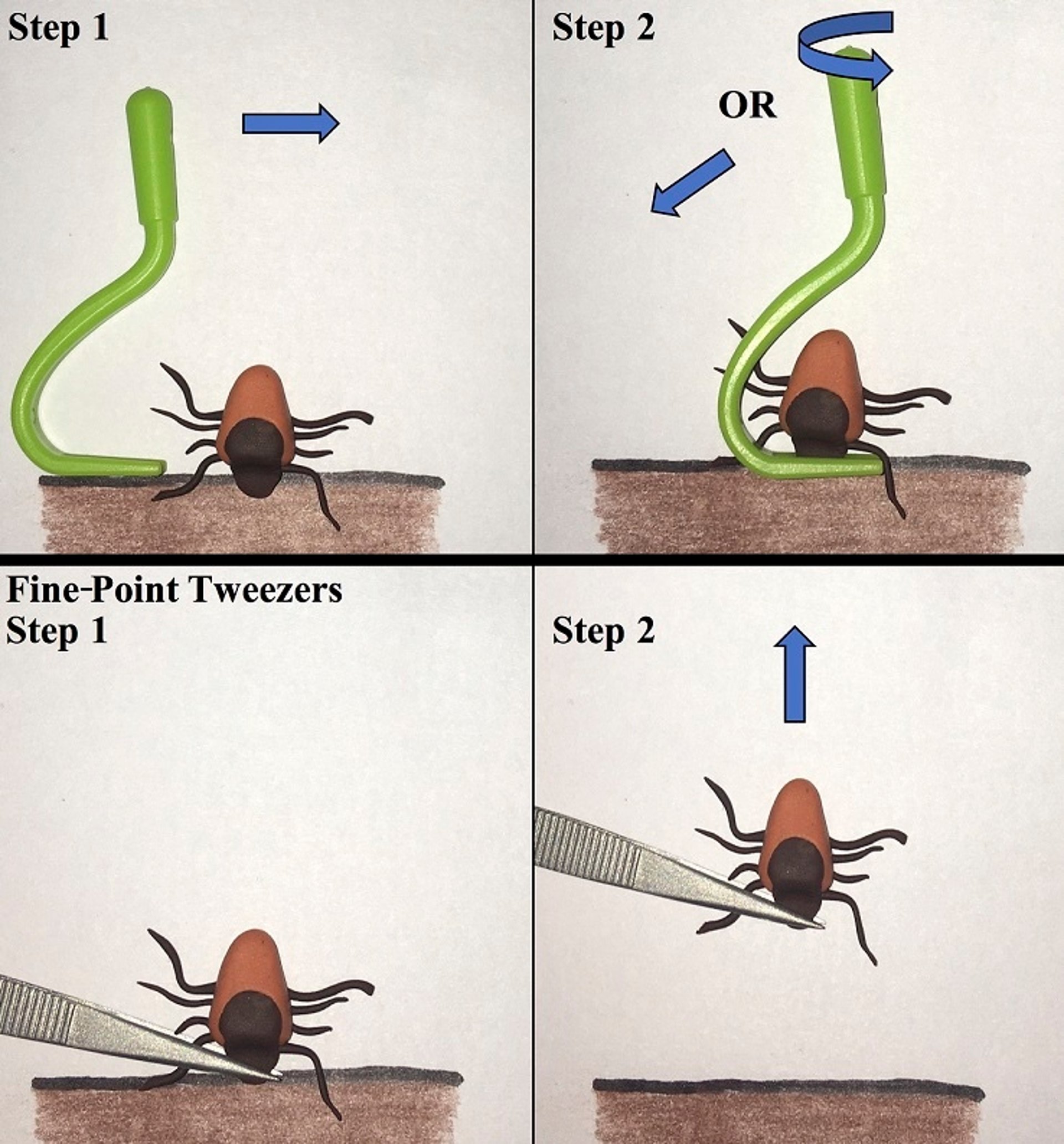 Tick removal