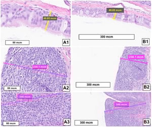 Changes in tracheal mucosa, Mycoplasma infection, photomicrographs
