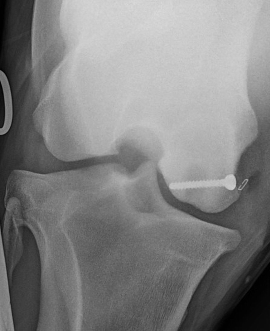Colocación de un tornillo de compresión transcondíleo, radiografía, caballo