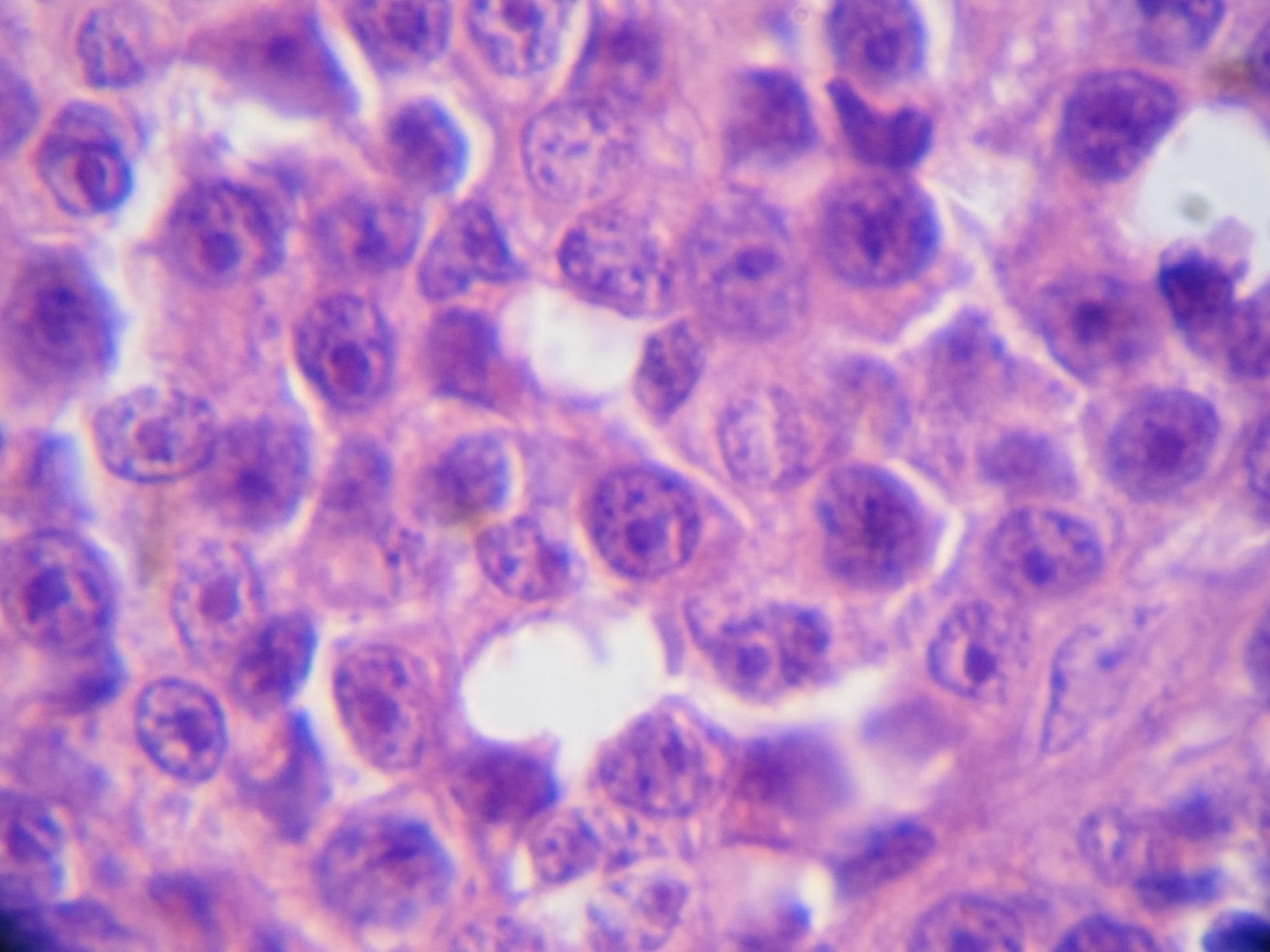 Transmissible venereal tumor, cytological appearance, dog