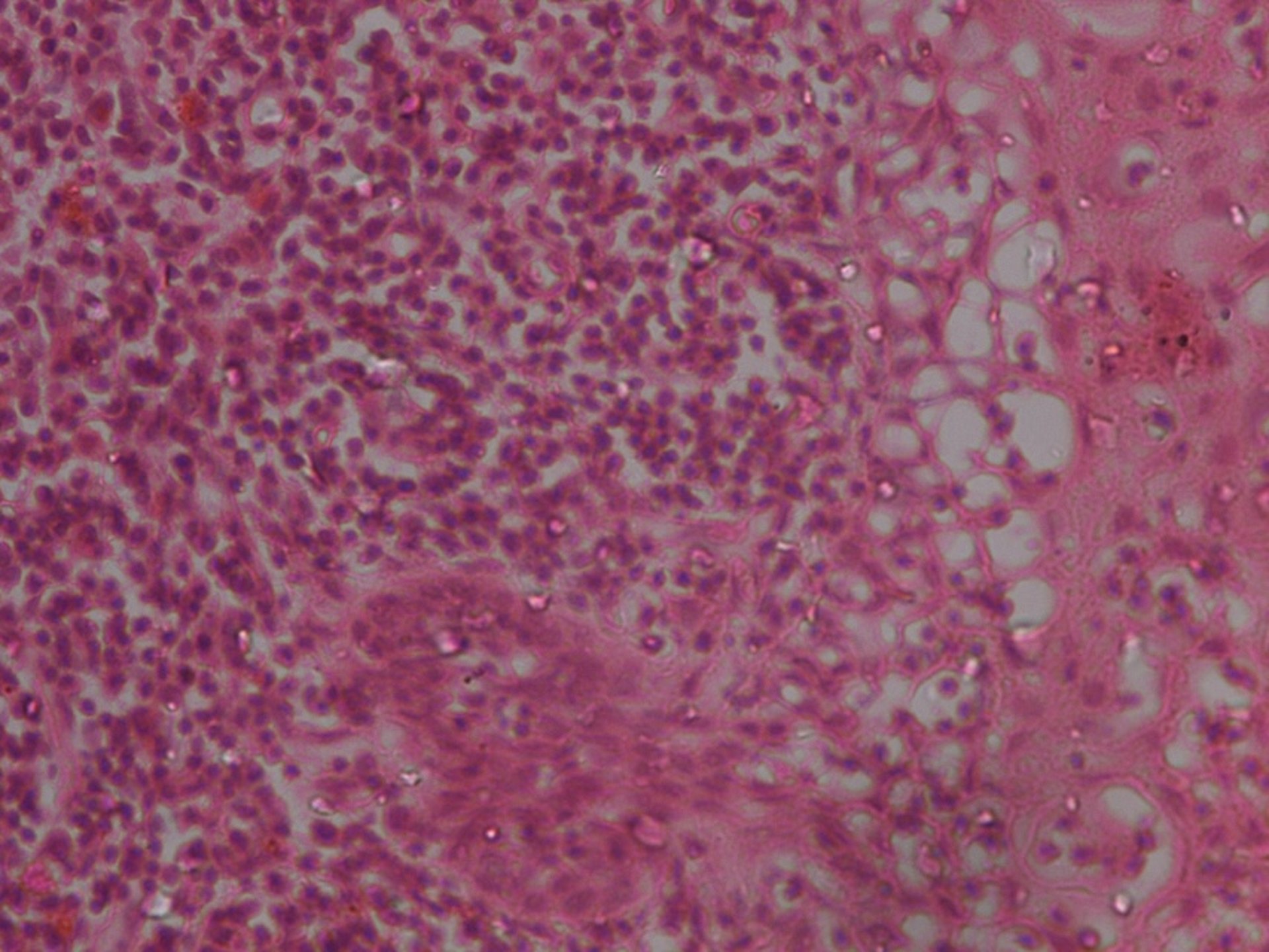 Transmissible venereal tumor, histological appearance, dog