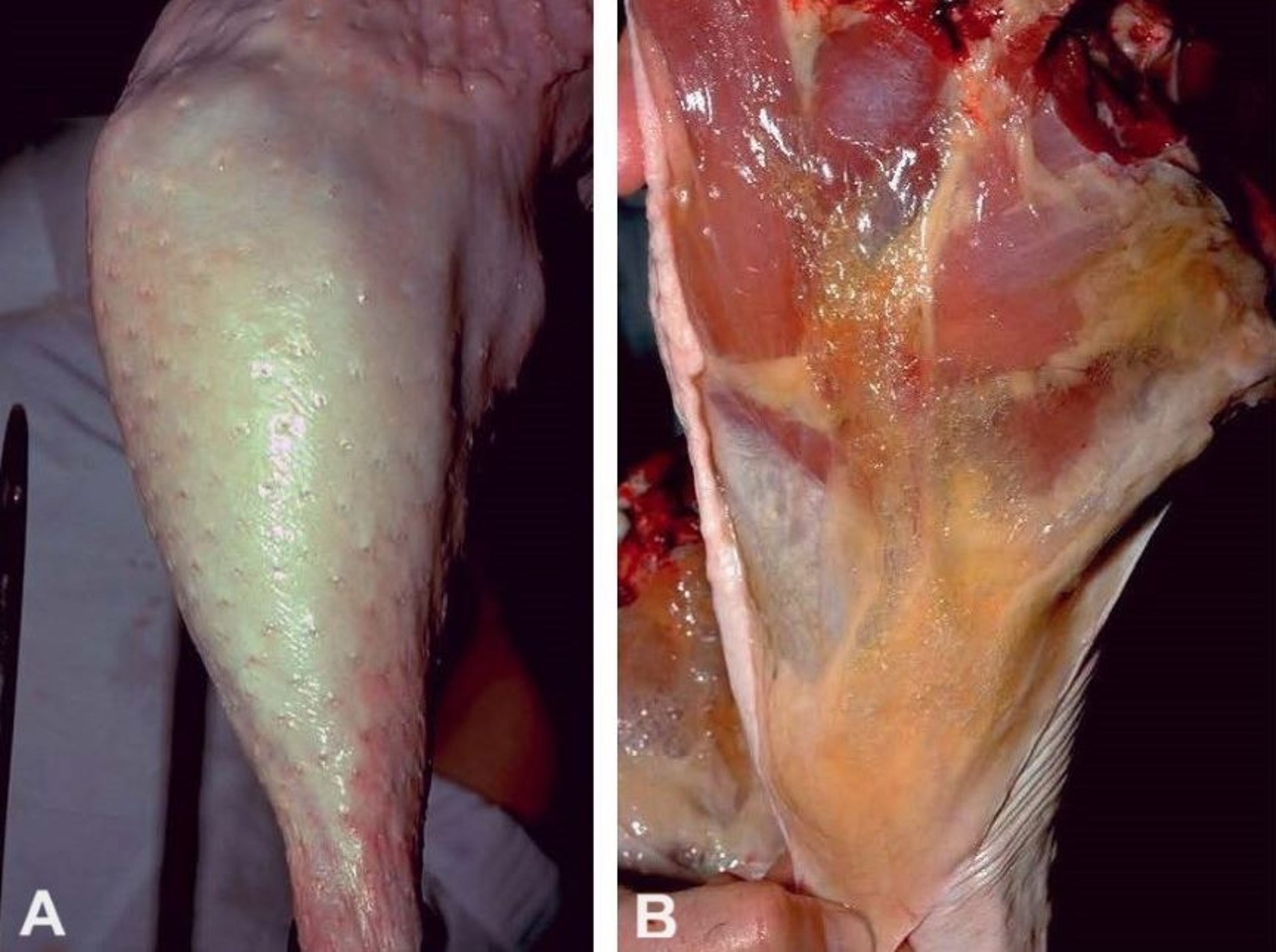 Transport myopathy, gross lesions, turkeys