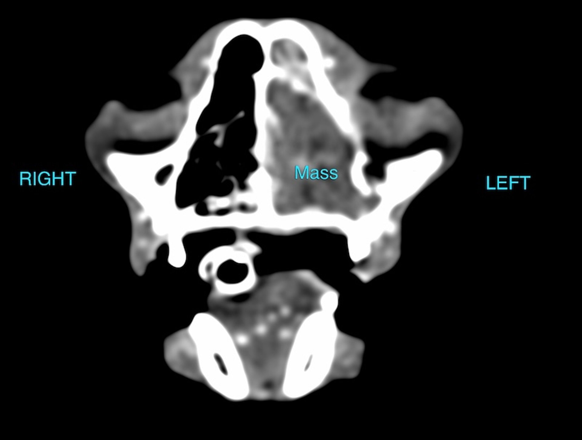 Transverse CT, skull, nasal mass, cat
