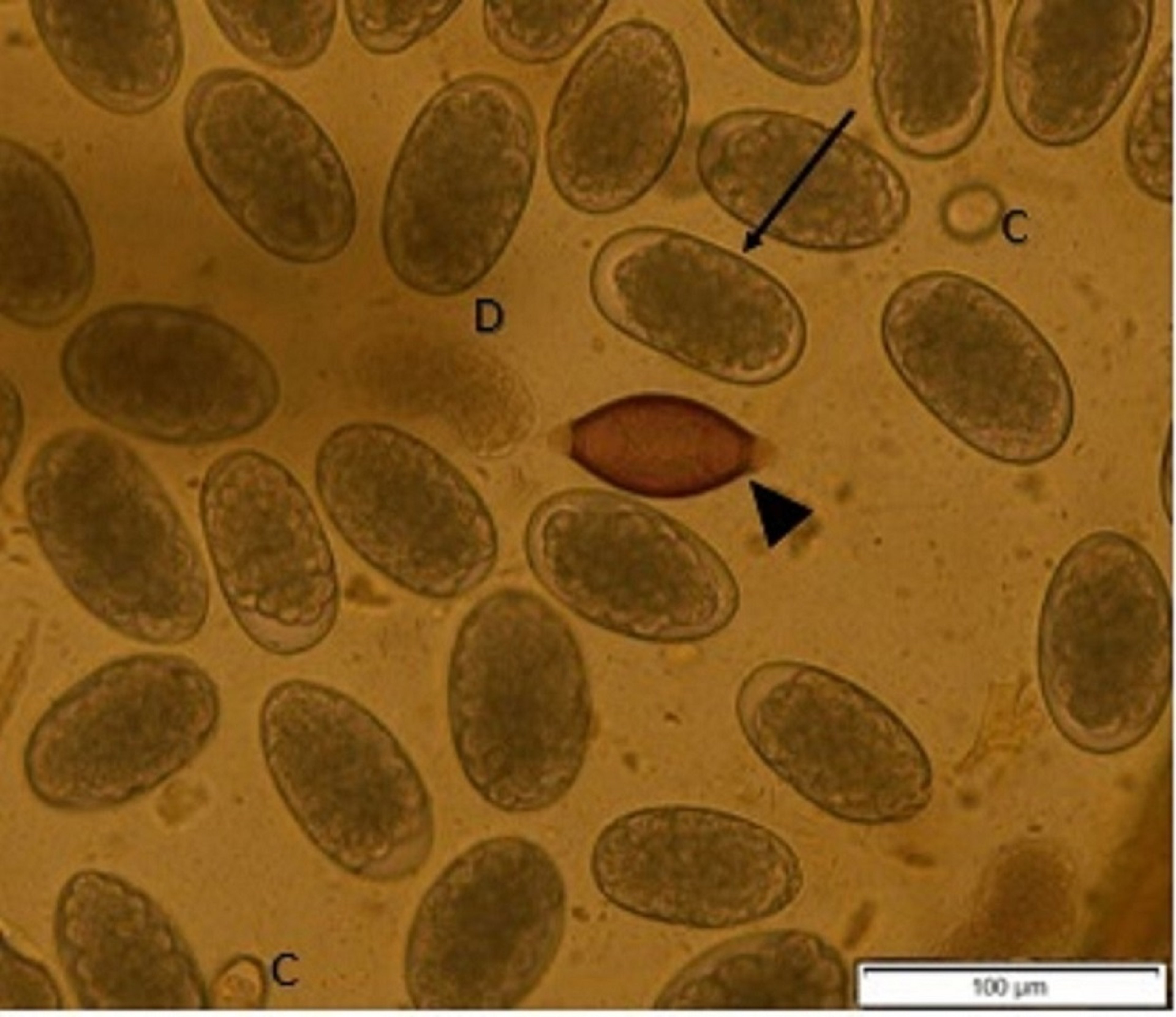 Huevos de <i >Trichuris</i>