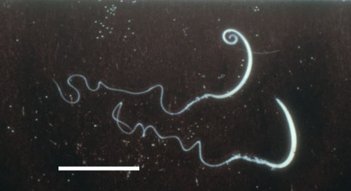 Adulto<i >Trichuris vulpis</i>, perro