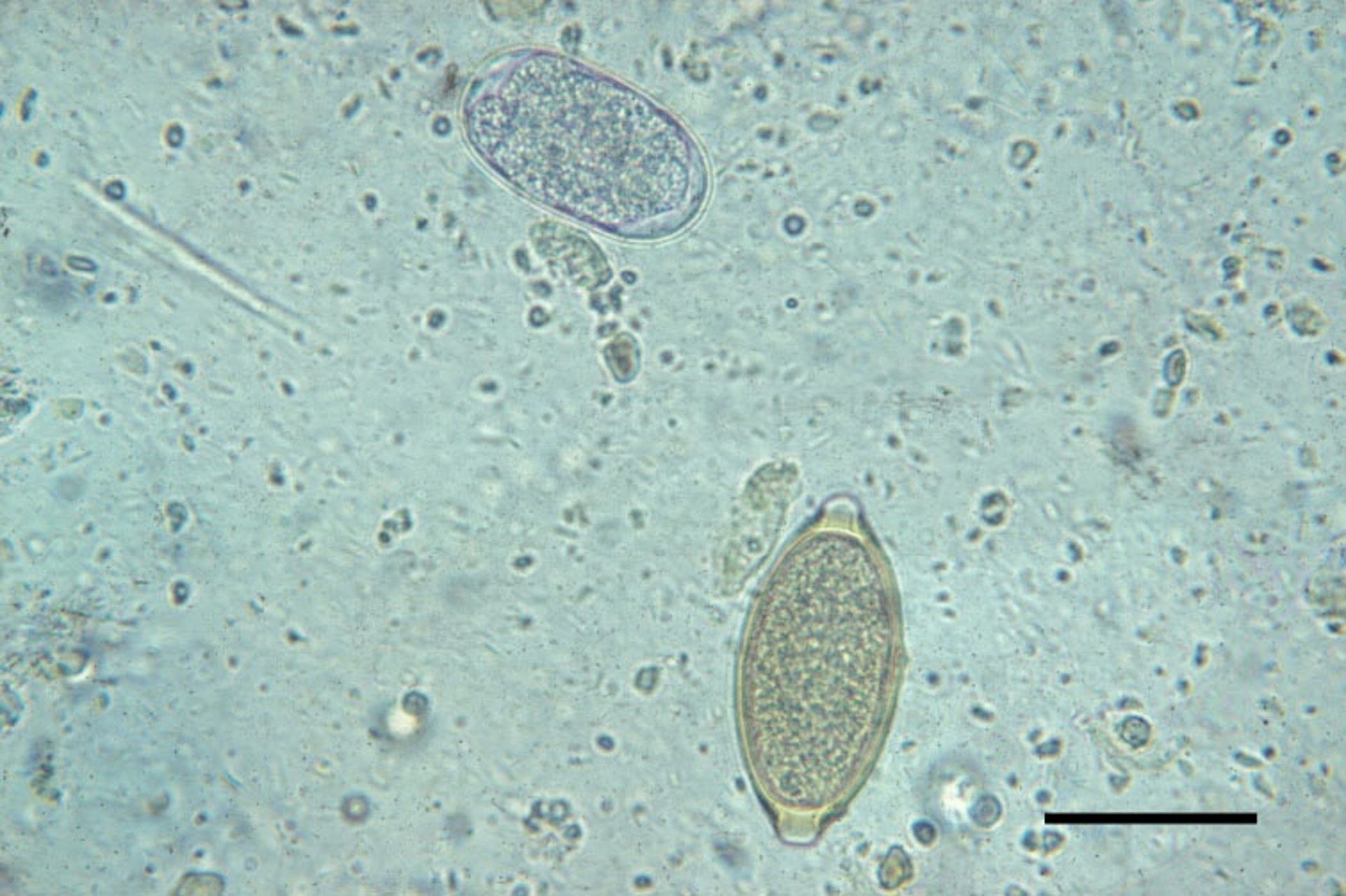 Huevos de <i >Trichuris vulpis</i> y anquilostomas, perro