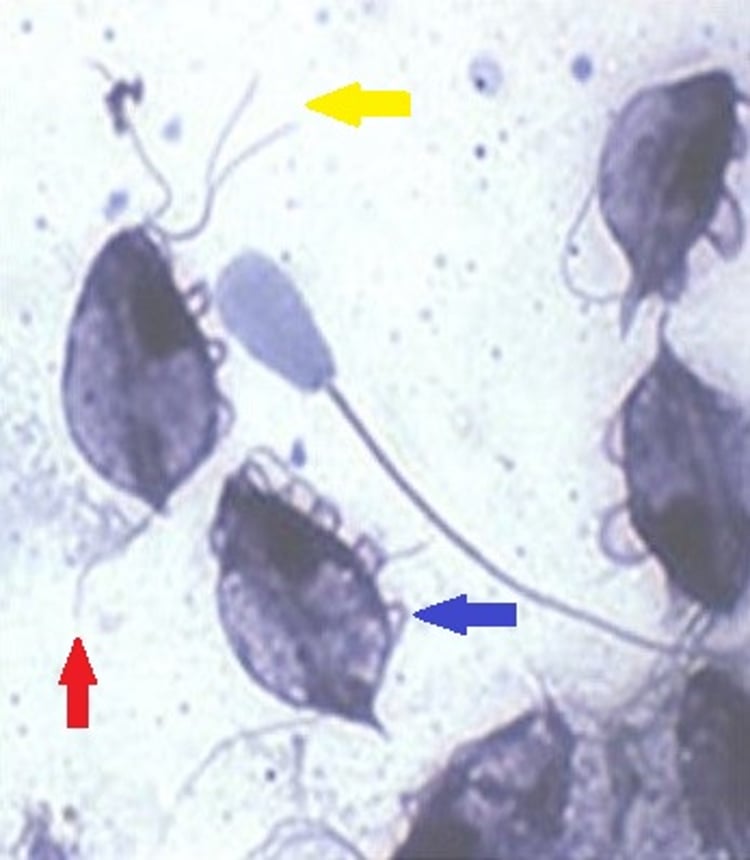 <i >Tritrichomonas foetus</i> with bovine spermatozoon