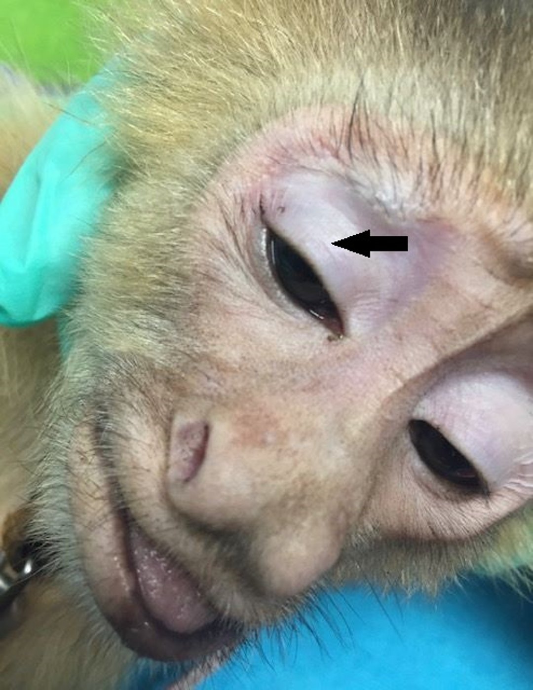 Tuberculosis test site, capuchin